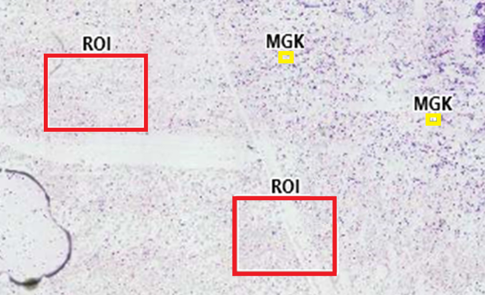Automatic selection of regions of interest (ROI) and identification of megakaryocytes (MGK).