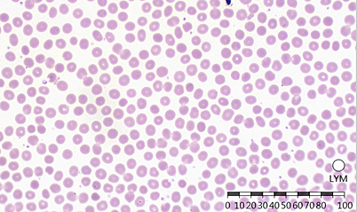 Analysis of platelets