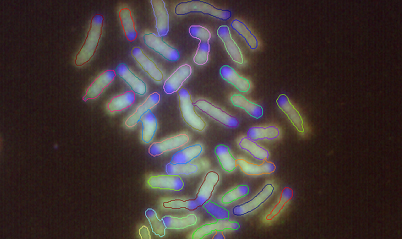 Chromosomenanalyse mit der FISH-Methode