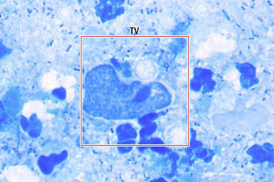 Trichomonas vaginalis