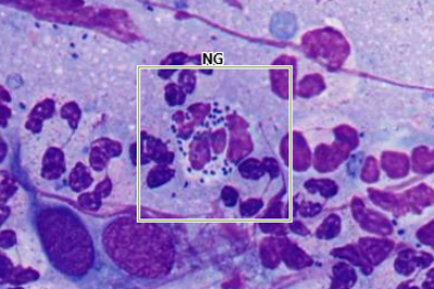 Candida Spp.