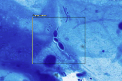 Fungal spores