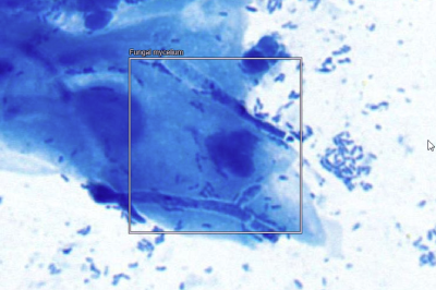 Fungal mycelium