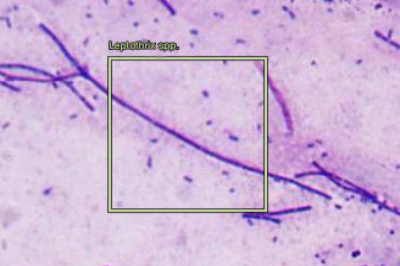 Leptothrix spp.